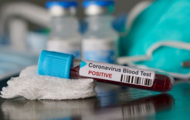 В Чехии подтвердили первые случаи коронавируса